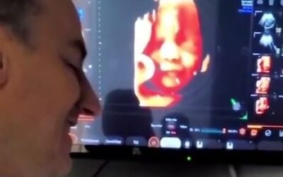 MUST SEE: 32-Week Old Unborn Baby in the Womb Smiles to Daddy’s Voice in Ultrasound (VIDEO)